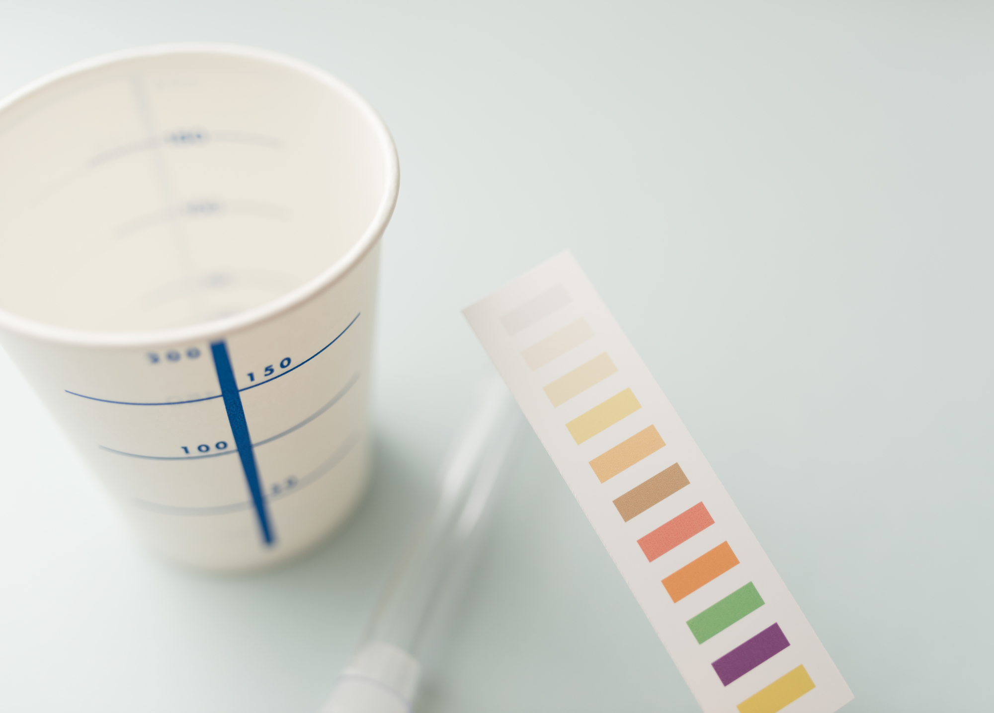 検尿のイメージ